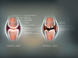 Knee Diagram | Registered Physical Therapists Utah
